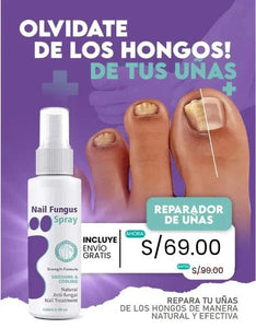 💥 “Dile adiós a los hongos, grietas y mal olor con el poder de Nail Fungus”