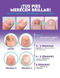 💥 “Dile adiós a los hongos, grietas y mal olor con el poder de Nail Fungus”