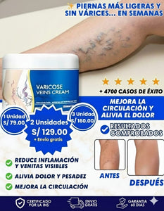 VARICOSE CREAM-PREMIUM ⭐⭐⭐⭐⭐