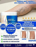 VARICOSE CREAM-PREMIUM ⭐⭐⭐⭐⭐