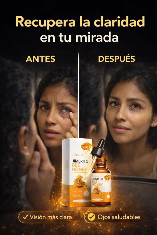 JIMERITO BEE HONEY - ELIMINA LAS CATARATAS