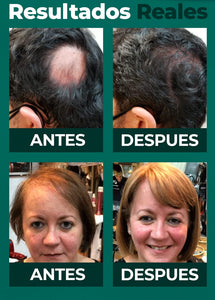 GNE DHT- BLOCKER-BOTOX CAPILAR-PREMIUM⭐⭐⭐⭐⭐