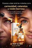 JIMERITO BEE HONEY - ELIMINA LAS CATARATAS