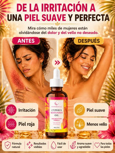 🌿 Aceite de Ciperus Rotundus – Reduce el Crecimiento del Vello de Forma Natural