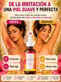 🌿 Aceite de Ciperus Rotundus – Reduce el Crecimiento del Vello de Forma Natural