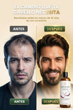 🚿 EXCALVO SHAMPOO — FORTALECE, NUTRE Y REVITALIZA TU CABELLO DESDE LA RAÍZ 💥