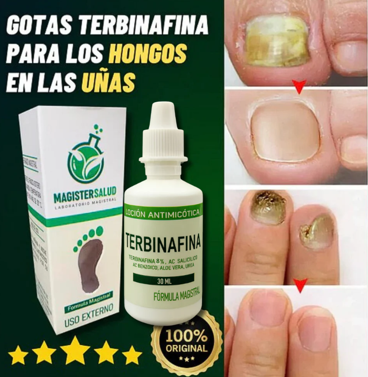 Terbinafina En Gotas Para Hongos En Tus Uñas