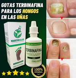 Terbinafina En Gotas Para Hongos En Tus Uñas
